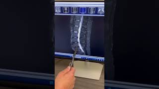 Progressive Spine & Orthopaedics