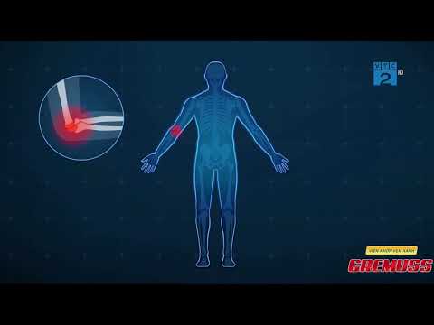 VTC2 - Những điểm độc đáo của Viên khớp Vẹm xanh GREMUSS