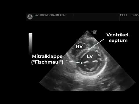 Echocardiography: Basic sections