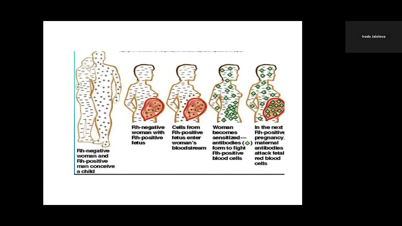 Rh-Negative pregnancy