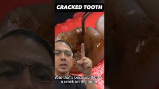 How to EASILY Extract a Cracked Tooth (First Molar) | In Office to Hands On Dental Training #shorts