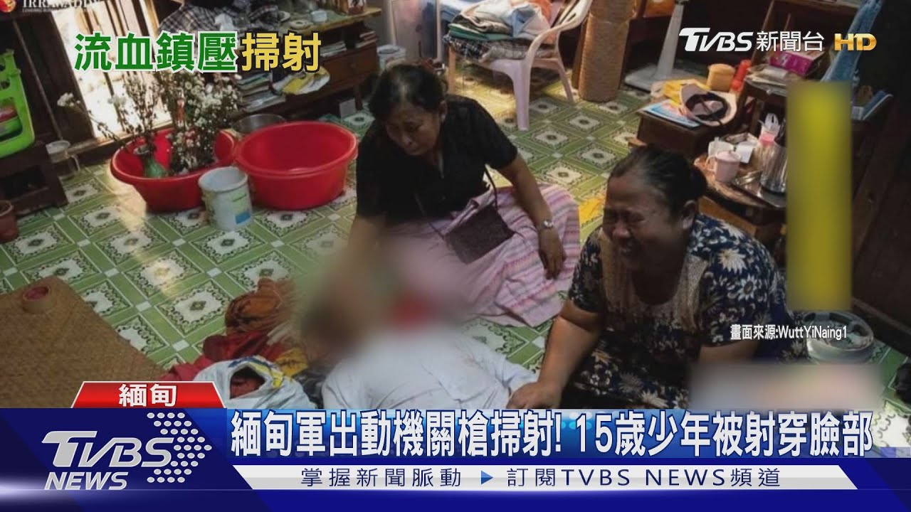 緬甸軍出動機關槍掃射! 15歲少年被射穿臉部