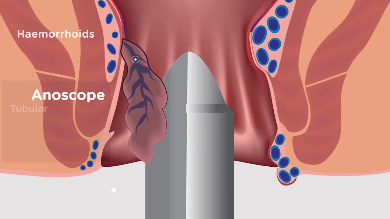 Antonio Bergantino-17