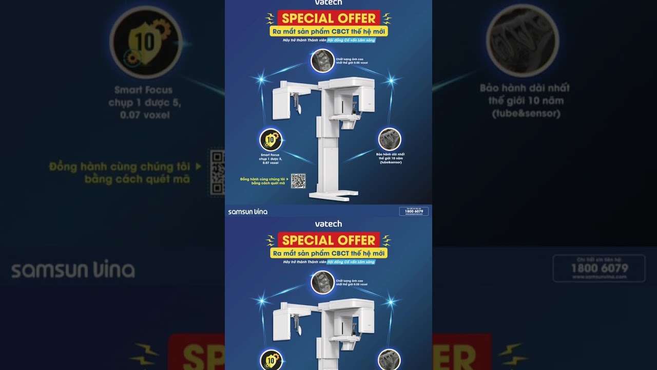 Siêu phẩm CBCT Smart X: Chụp 1 được 5 với 0.07 voxel!