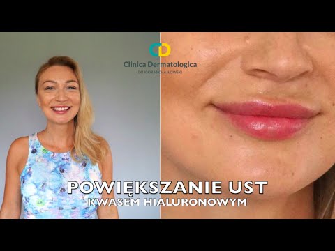 Zwiększyć rozmiar penisa Jakie witaminy są potrzebne, aby zwiększyć człon