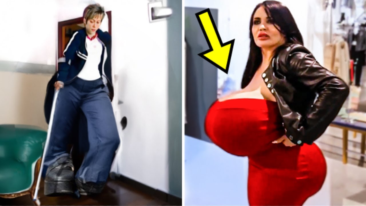 Bizarre People With The Most Extraordinary Body Parts