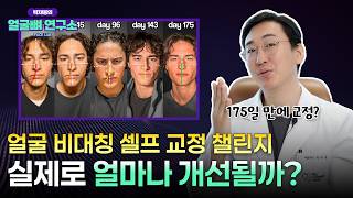 안면비대칭 셀프 교정, 175일 만에 가능? 팩트 체크해봤습니다