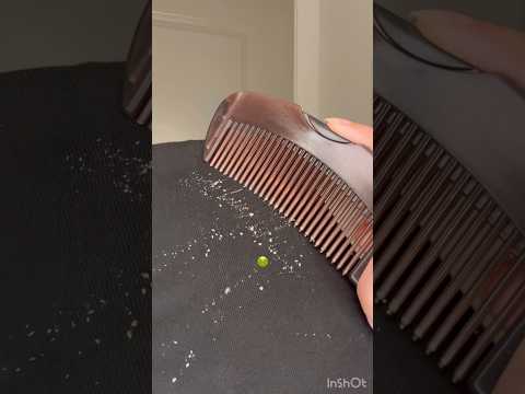 All This is coming out from My “CLEAN” scalp!!🤢😭(dandruff comb) #haircare #dandruff #hair #shorts