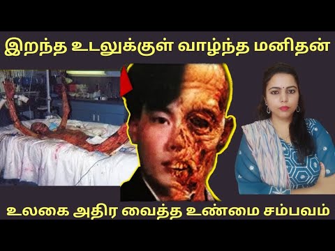 Tokaimura Nuclear Accident Hisashi Ouchi in Tamil | Most Radioactive Man in History #tamil