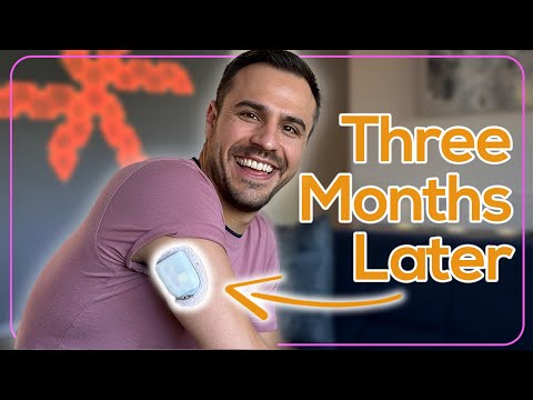 Ich habe Omnipod 5 3 Monate lang verwendet – Vergleich mit DIY