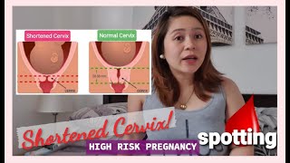 Shortened Cervix, Spotting and Risky Pregnancy Discussion | My Experience