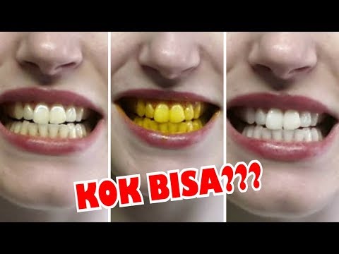 download video viral Cara Alami Memutihkan Gigi Dengan Kunyit, download Cara Alami Memutihkan Gigi Dengan Kunyit gratis, unduh Cara Alami Memutihkan Gigi Dengan Kunyit