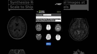 NVIDIA Just Solved the Biggest Data Problem in Medical AI