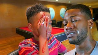 PENCIL STUCK IN MY EYE PRANK