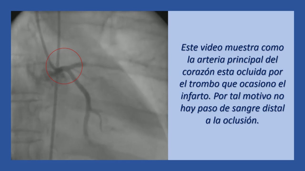 Carlos Alberto Aguirre Molina-15