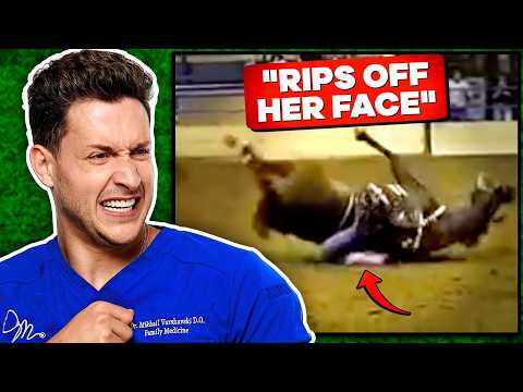 Doctor Reacts To Shocking Horse Riding Injuries