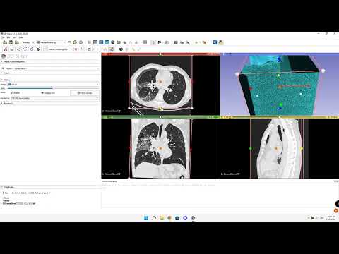 Lung volume rendering in 3D Slicer