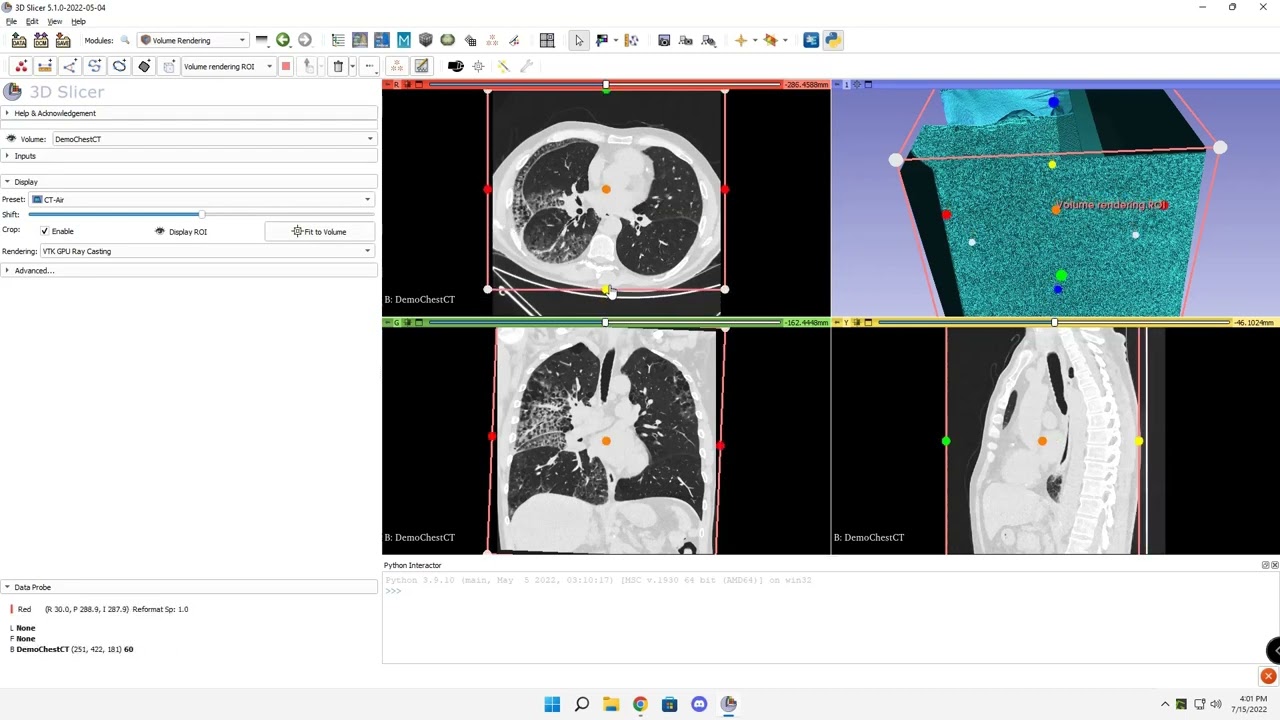 Lung volume rendering in 3D Slicer