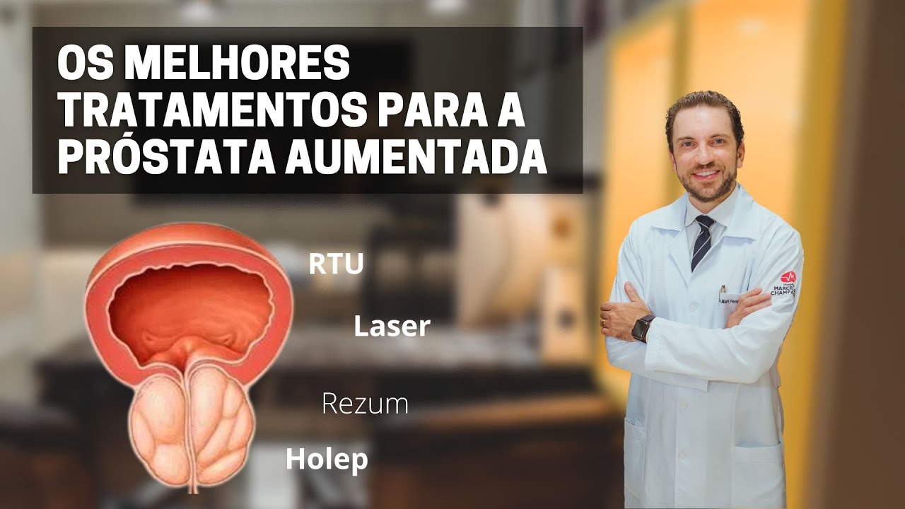 Entenda os melhores tratamentos para a próstata aumentada (HPB)