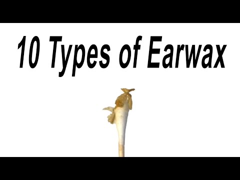 10 Types of Earwax
