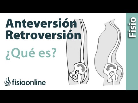 Ecografía de la columna cervical en Samara Carga con osteocondrosis