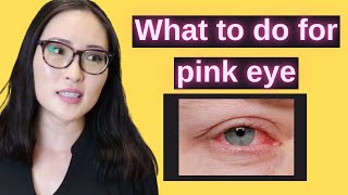 WHAT TO DO FOR PINK EYE AT HOME (how to tell if you have pink eye)| What to use for pink eye| Dr Cho