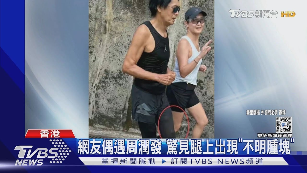 捕捉野生周潤發!跑步時被發現「腿上有腫塊」 醫師:可能靜脈曲張