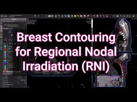 Breast Contouring Regional Nodes... a Walkthrough