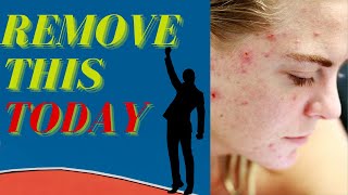 how to get rid of acne scars | how long does it take for acne scars to go away | Best ingredients HB
