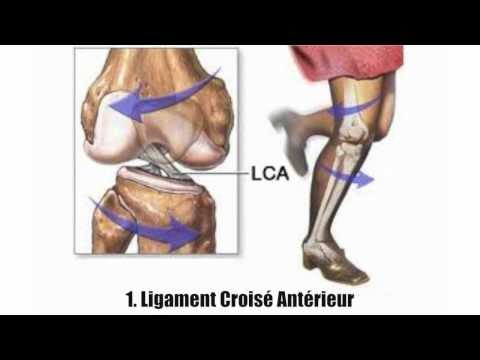 comment soigner syndrome de l'essuie glace