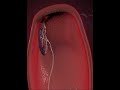 Placenta Delivery 3D Animation