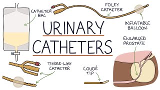 Urinary Catheters