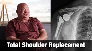 Total Shoulder Replacement - Paul Fiso Patient Success