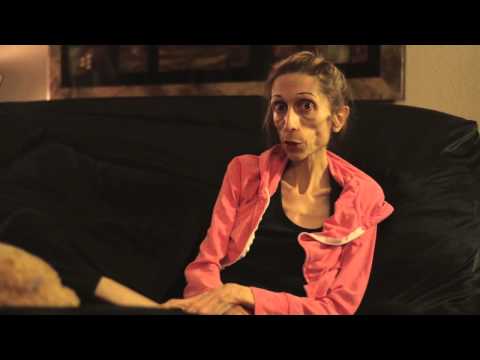18 kg anorexic woman begs for help after hospitals say she is too thin to treat | News24