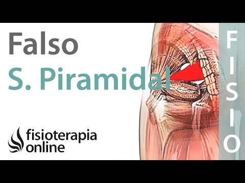 Síndrome del piramidal. ¿Cómo diferenciar un caso falso de uno verdadero?