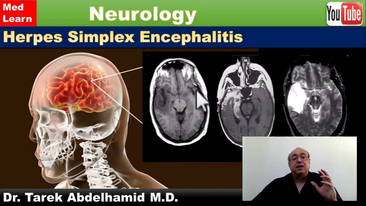 Medlearn  (NEW) Video