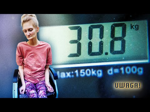 Uważała, że jest za gruba, dziś jest przykuta do łóżka. Poruszająca historia Olgi (UWAGA! TVN)