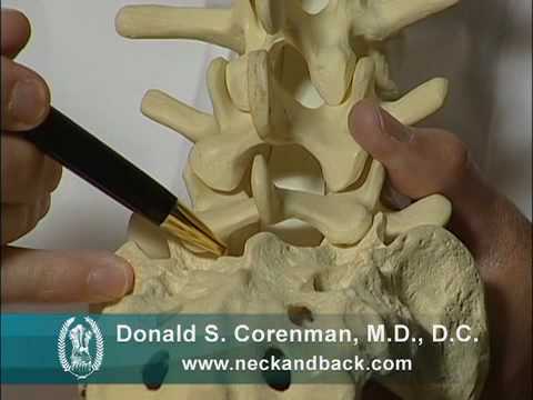 What is a Microdiscectomy for Lumbar Disc Herniation, Low Back Pain and Leg Pain?