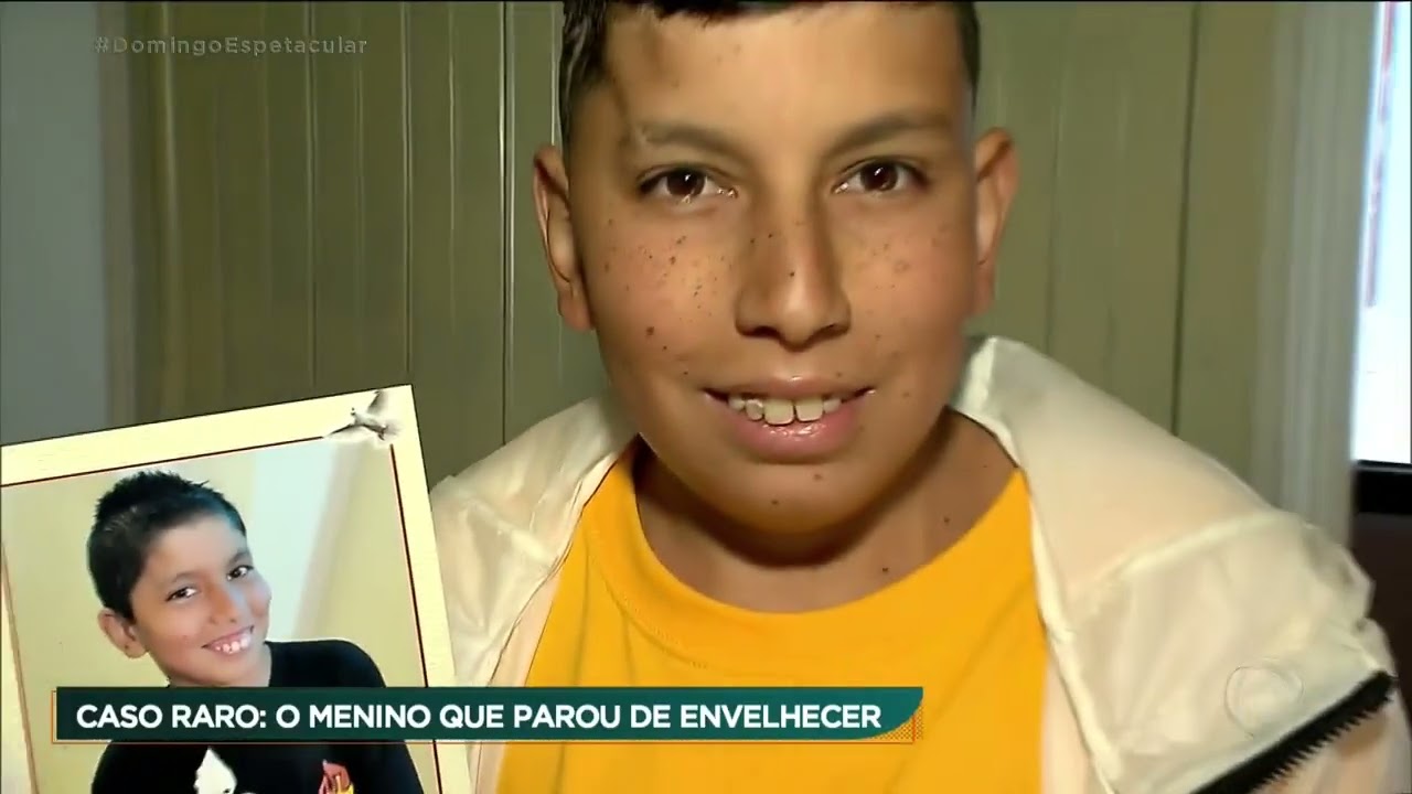 Caso raro: o menino que parou de envelhecer