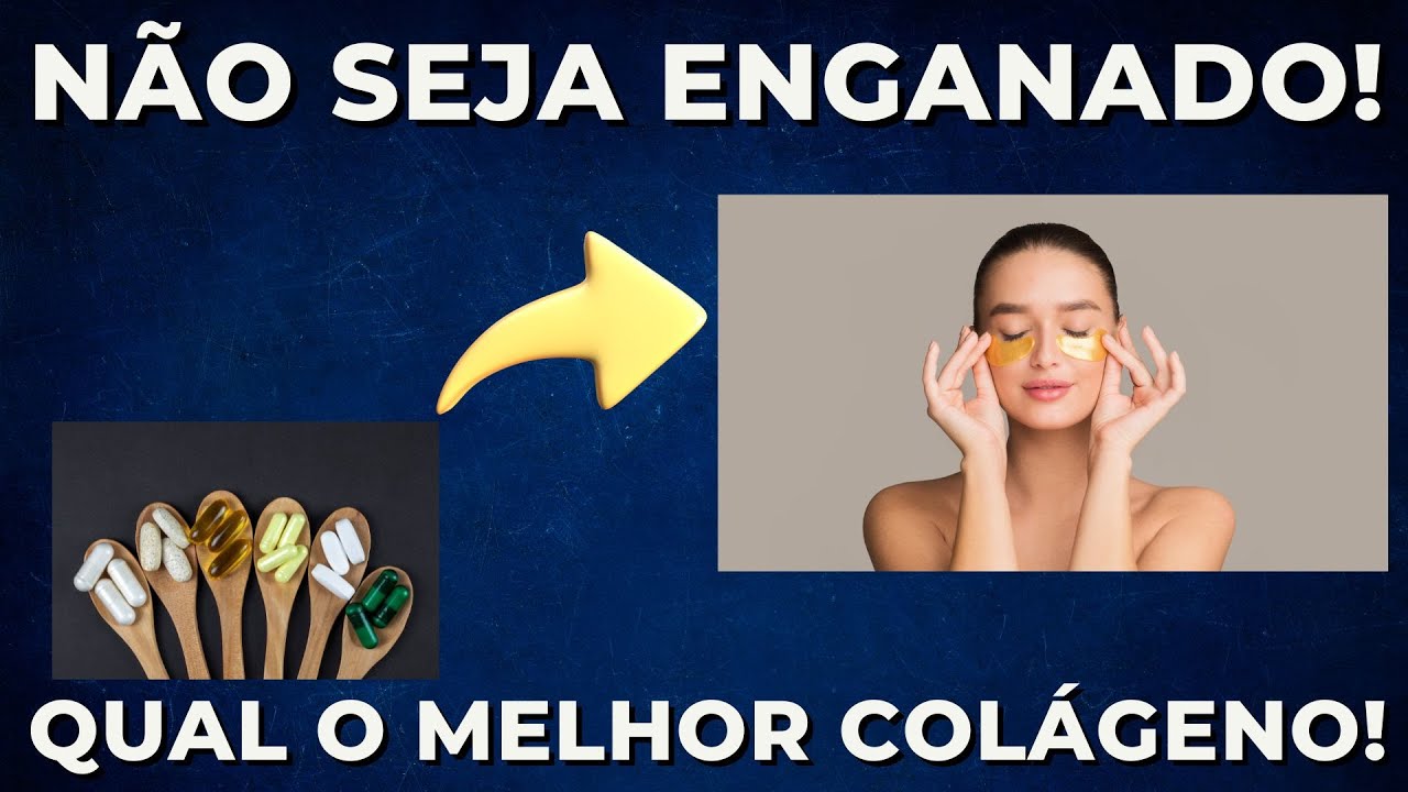 Como aumentar o colágeno de verdade? Com suplementos e sem enrolação!