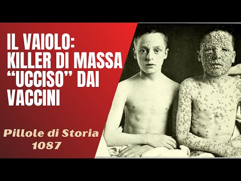 , title : '1087- Il vaiolo : killer di massa "ucciso" dal primo vaccino della storia [Pillole di Storia]'