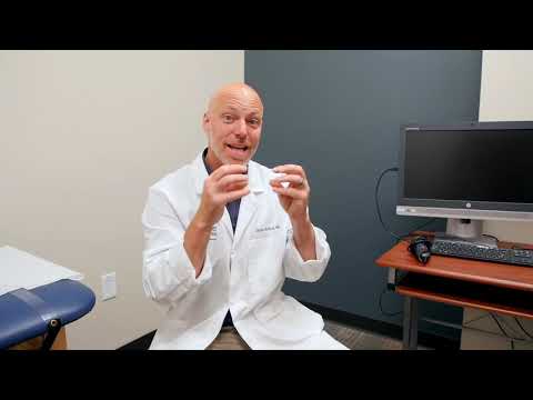 What to expect after radial head fractures