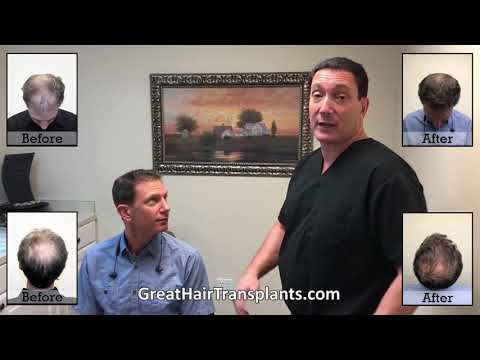 Dr. Brett Bolton patient Al MaxHarvest procedure

