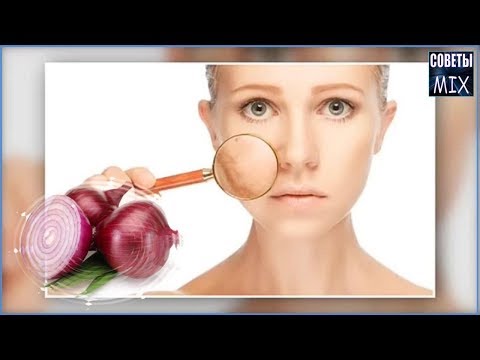 Лазерное пигментные пятна Чем скрыть пигментацию на лице