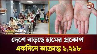 দেশে বাড়ছে হামের প্রকোপ একদিনে আক্রান্ত ১,২১৮ | Measles Outbreak | Channel 24