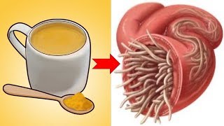 Natural Ways To Get Rid Of Intestinal Worms In No Time