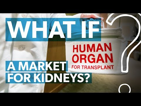 What if you could legally sell your kidney? | WHAT IF?