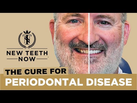 Cure for Periodontal Disease