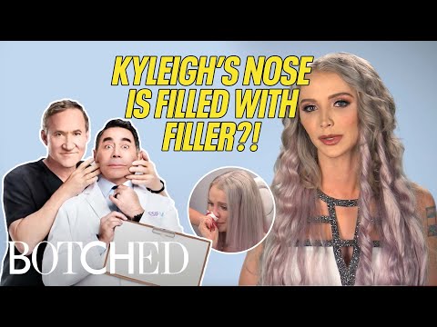 Kyleigh's Nose is Filled with FILLER & She Wants It Fixed! | Botched | E!