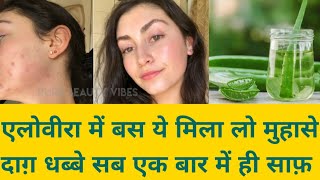 Remove pimples and scars permanently/how to remove pimples  /glowing and clear skin with aloevera